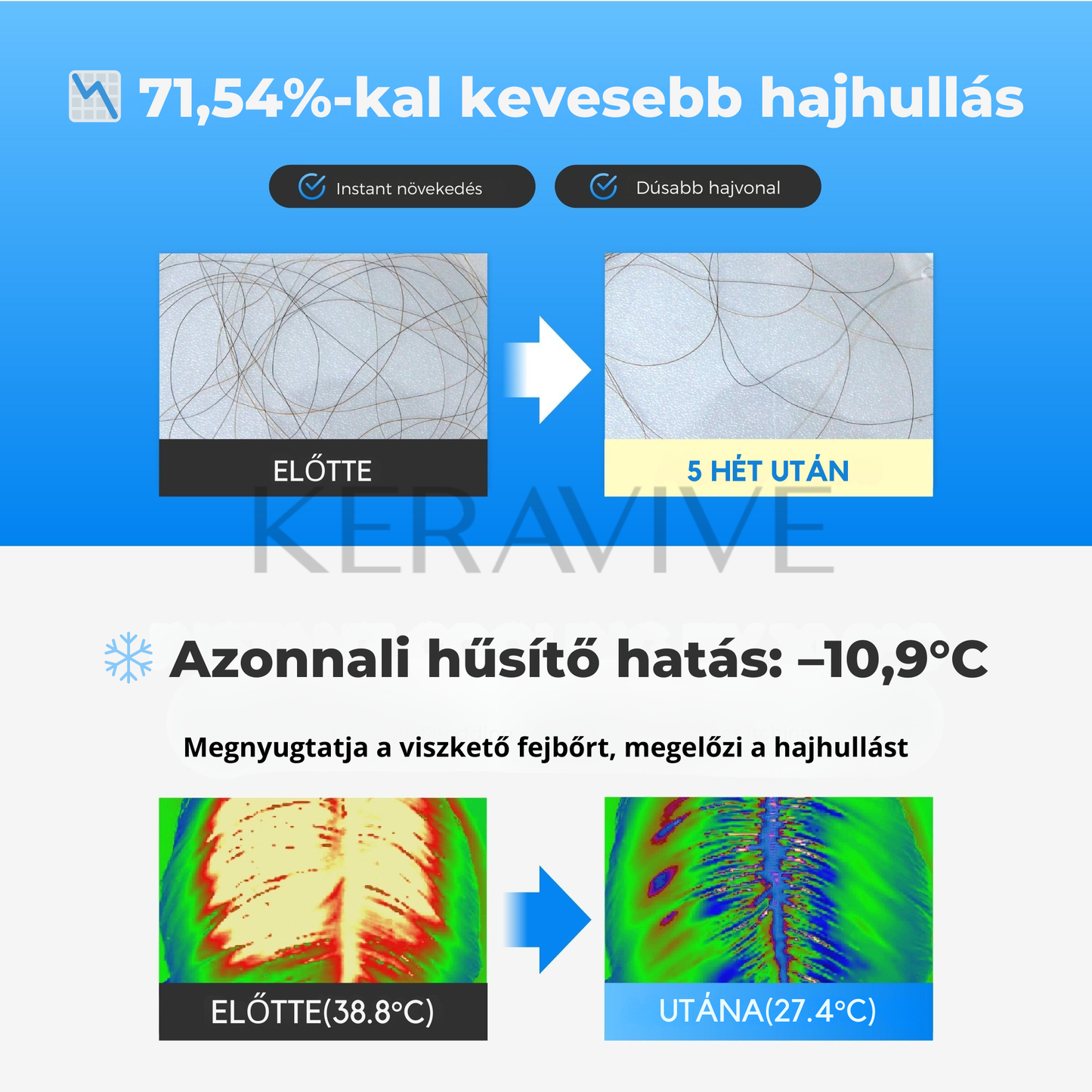 Keravive – Ampulla a dúsabb, erősebb hajért